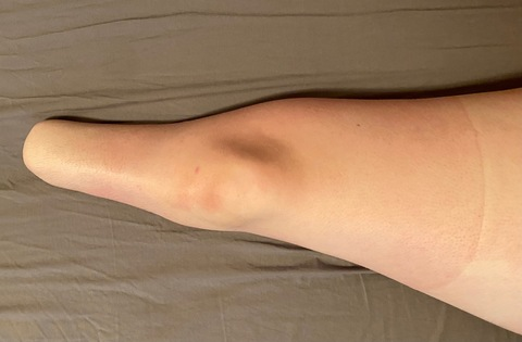 1 Nub Gets Loved @u230291232 cover picture