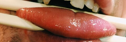 u33710344 @ylrac cover picture